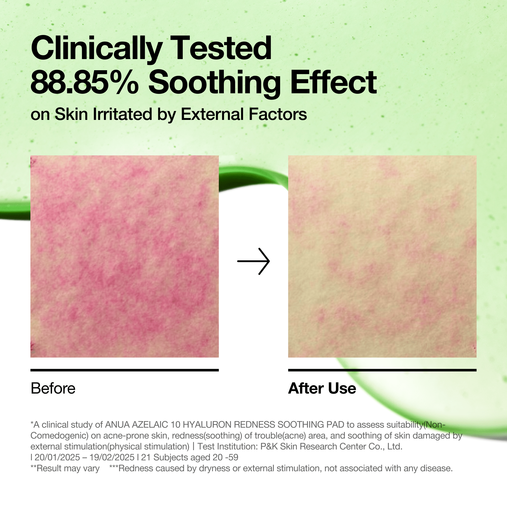 Azelaic 10 Hyaluron Redness Soothing Pad